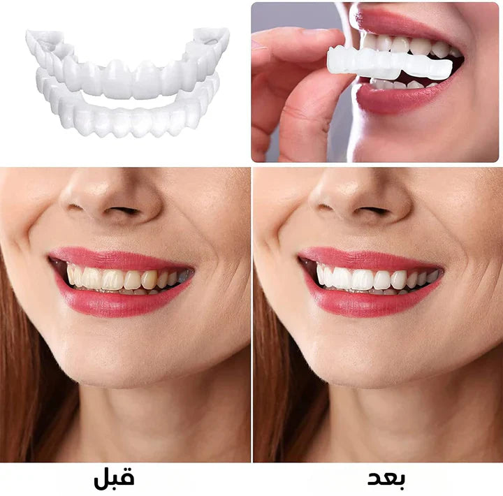 ابتسامة هوليود